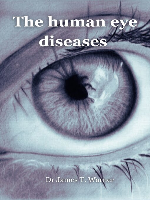 Title details for The human eye diseases by Dr James T. Warner - Available